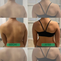 Instant Posture Corrector | Adjustable, Comfortable & Pain-Relieving